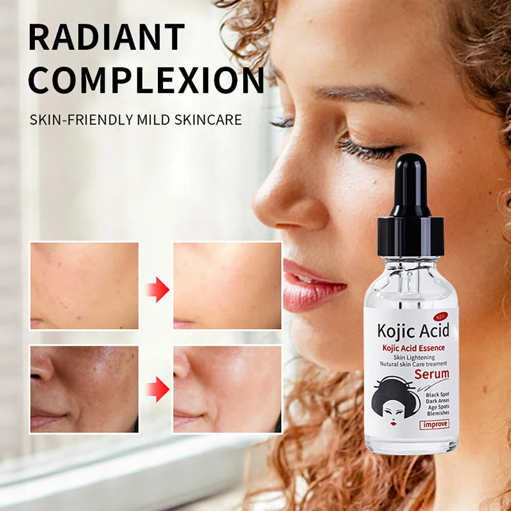 Kojic Acid Moisturizing Cream Body Care Remove Skin Nourishing Revitalizing Brightening Moisture Protection Skincare Body Lotion