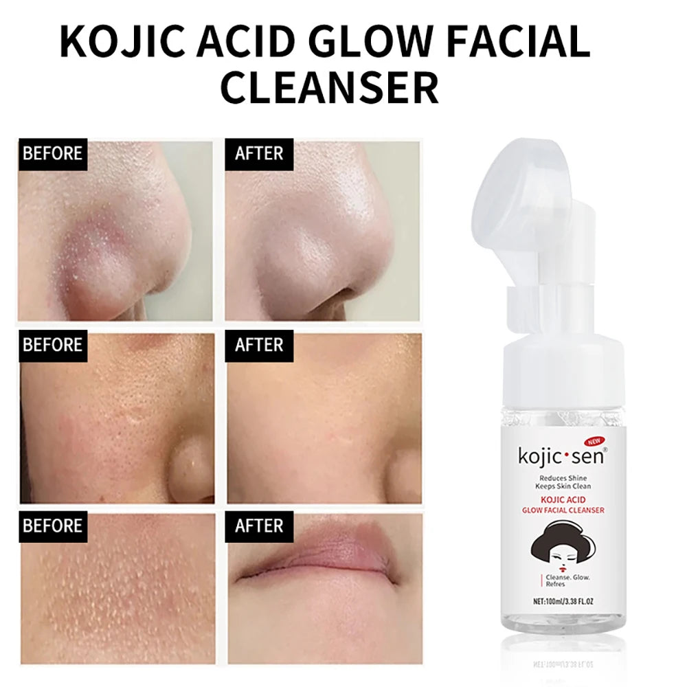 Kojic Acid Moisturizing Cream Body Care Remove Skin Nourishing Revitalizing Brightening Moisture Protection Skincare Body Lotion